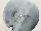 BOB DYLAN RESTLESS FIREWALL X-Ray USSR Record Roentgen Bones Ribs Music Vinyl