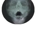 Otis Redding Russian X-ray Bone Record Skull US Seller Roentgen Free Shipping