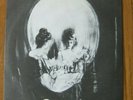 DAMNED..STRETCHER CASE..7
