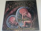 MALIGNANCY Intrauterine Cannibalism brutal Death Metal Vinly
