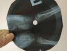 ELVIS PRESLEY SURRENDER X-Ray USSR Record Roentgen Bones Ribs Music Vinyl