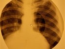 Bob Marley - Roots Rock Reggae X-RAY OF THE USSR X-RAY BONE RECORD