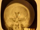 Paul & Paula - Hey Paula X-RAY OF USSR X-RAY BONE RECORDING