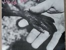 DEAD KENNEDYS - PLASTIC SURGERY DISASTERS 1982 STATIK REC MV 013001 PORTUGAL LP