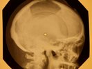 Beatles - Baby It's You X-RAY OF THE USSR X-RAY BONES RECORDING