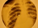 Robert Gordon - Sea Cruise X-RAY OF USSR X-RAY BONES RECORDING