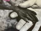 Dead Kennedys - Plastic Surgery Disasters NEW VINYL