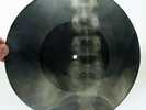 X-RAY 78rpm KATYNA RANIERI Canzone da due soldi USSR ROENTGEN BONES Spine 1950s