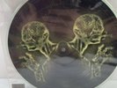 TOOL Stinkfist 10