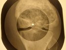 Beatles - Please Mister Postman X-RAY OF THE USSR X-RAY BONES RECORDING