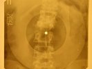 Jefferson Airplane - Somebody To Love X-RAY OF USSR X-RAY BONE RECORDING