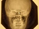 Rolling Stones - You Better Move On X-RAY OF USSR X-RAY BONES RECORD