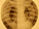 Jefferson Airplane - Volunteers X-RAY OF THE USSR X-RAY BONE RECORDING