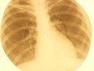 Doors - Love Street X-RAY OF THE USSR X-RAY BONE RECORDING