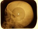 Beatles - Back In The U.S.S.R. X-RAY OF THE USSR X-RAY BONES RECORDING