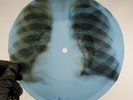 BOB DYLAN VISIONS OF JOHANNA X-Ray USSR Record Roentgen Bones Ribs Music Vinyl