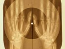 Doors - You Make Me Real X-RAY OF THE USSR X-RAY BONES RECORDING