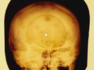 Zombies - She's Not There X-RAY OF USSR X-RAY SKULL BONES RECORD
