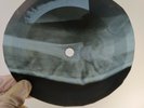 PATSY CLINE STUPID CUPID X-Ray USSR Record Roentgen Bones Ribs Music Vinyl