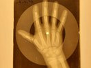 Lots 10 pieces X-RAY OF THE USSR X-RAY BONES RECORDS