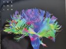 MUSE The 2nd Law Vinyl LP Signed by Matt Bellamy