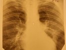 Kinks - A Well Respected Man X-RAY OF USSR X-RAY BONES RECORDING