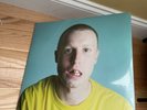 Injury Reserve - The Dentist Office Series (President Gator) LP, Album