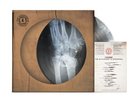KASABIAN | THE ALCHEMIST’S EUPHORIA - PICTURE Ltd Edition Vinyl 2000 Sold Out