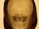Beatles - Michelle X-RAY SKULL OF THE USSR X-RAY BONES RECORDING