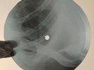 NINA SIMONE SATIN DOLL X-Ray USSR Record Roentgen Bones Ribs Music Vinyl
