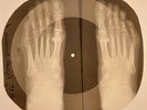 Roy Orbison - Running Scared X-RAY FOOT BONES RECORDS USSR 9