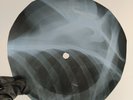 NINA SIMONE GIN HOUSE BLUES X-Ray USSR Record Roentgen Bones Ribs Music Vinyl