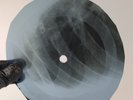 BEATLES WE CAN WORK IT OUT X-Ray USSR Record Roentgen Bones RIBS Music Vinyl