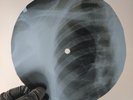 NINA SIMONE CENTRAL PARK BLUES X-Ray USSR Record Roentgen Bones Ribs Music Vinyl