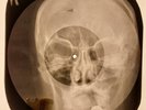 Bob Marley - Buffalo Soldier  X-RAY SKULL BONES RECORDS USSR 195