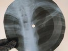 ARMSTRONG UNDER A BLANKET OF X-Ray USSR Record Roentgen Bones Ribs Music Vinyl