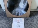 KASABIAN The Alchemist’s Euphoria Vinyl Bones Picture Disc 2000 RARE EXCLUSIVE