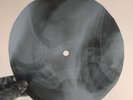 PINK FLOYD FAT OLD SUN  X-Ray USSR Record Roentgen Bone Ribs Music Vinyl