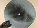 NINA SIMONE ANOTHER SPRINGX-Ray USSR Record Roentgen Bones Ribs Music Vinyl