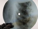 DAVID BOWIE JANINE X-Ray USSR Record Roentgen Bones Ribs Music Vinyl