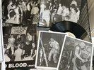 Agnostic Front United Blood Legacy Signed By Roger Lmt Ed  102 Made