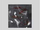 Duran Duran Danse Macabre Translucent Galaxy Vinyl + CD + signed print presale