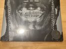 Travis Scott Utopia 2 Disc Vinyl Album Cover #5 Sealed New IN HAND