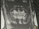 Travis Scott Utopia 2 Disk Vinyl LP Cover 5 Limited Edition FAST SHIPPING