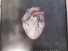 Alice In Chains – Black Gives Way To Blue (2009) 2 x Clear Vinyl LP w/ CD