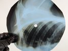 NINA SIMONE MY BABY JUST CARE X-Ray USSR Record Roentgen Bones Ribs Music Vinyl