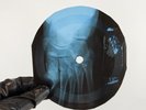 VELVET UNDERGROUND STORY OF MY X-Ray USSR Record Roentgen Bones Ribs Music Vinyl
