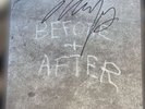 Neil Young Signed Vinyl - Before And After - Exclusive Limited Edition Clear LP