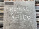 Neil Young - Before And After - NEW Vinyl LP Record Album Gatefold Cover