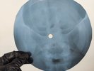 LED ZEPPELIN IMMIGRANT SONG X-Ray USSR Record Roentgen Bone Ribs Music Vinyl